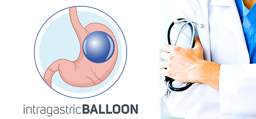 At The Center for Bariatrics in Tijuana, Mexico, the intragastric balloon is a new, minimally invasive bariatric treatment for people with obesity.